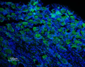 Anti-TRPM8 antibody used in IHC (Frozen sections) (IHC-Fr). GTX54866