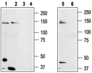 Anti-TRPM8 antibody used in Western Blot (WB). GTX54866