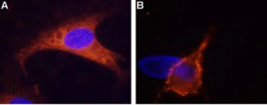 Anti-TRPM8 antibody used in Immunocytochemistry/ Immunofluorescence and Live cell imaging (ICC/IF LCI). GTX54866