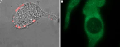 Anti-TRPM8 antibody used in Immunocytochemistry/ Immunofluorescence and Live cell imaging (ICC/IF LCI). GTX54866