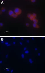Anti-TRPV5 antibody used in Immunocytochemistry/ Immunofluorescence (ICC/IF). GTX54868