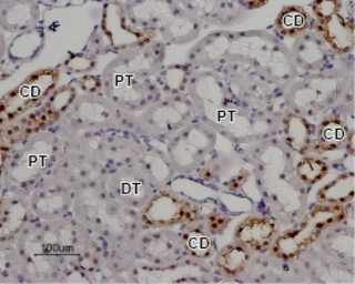 Anti-TRPV5 antibody used in IHC (Paraffin sections) (IHC-P). GTX54868
