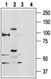 Anti-TRPV5 antibody used in Western Blot (WB). GTX54868
