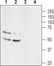 Anti-Kv1.1 antibody used in Western Blot (WB). GTX54875