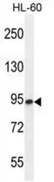 Anti-ENGase antibody used in Western Blot (WB). GTX54877