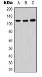 Anti-ADAMTS10 antibody used in Western Blot (WB). GTX54884