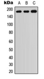 Anti-ADAMTS7 antibody used in Western Blot (WB). GTX54885