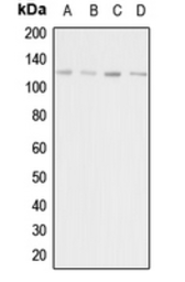 Anti-Adenylate cyclase 1 antibody used in Western Blot (WB). GTX54886