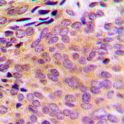 Anti-AKR1CL2 antibody used in IHC (Paraffin sections) (IHC-P). GTX54889