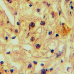 Anti-ABCA5 antibody used in IHC (Paraffin sections) (IHC-P). GTX54891