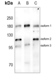 Anti-ABCA5 antibody used in Western Blot (WB). GTX54891