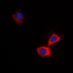 Anti-ABCB10 antibody used in Immunocytochemistry/ Immunofluorescence (ICC/IF). GTX54895