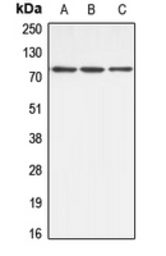 Anti-ABCB10 antibody used in Western Blot (WB). GTX54895