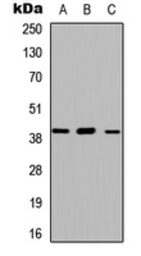 Anti-ABHD13 antibody used in Western Blot (WB). GTX54900
