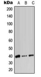 Anti-ADH7 antibody used in Western Blot (WB). GTX54902