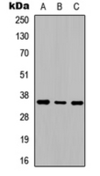 Anti-Adenosine A2b Receptor antibody used in Western Blot (WB). GTX54903