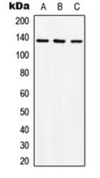 Anti-c-Abl antibody used in Western Blot (WB). GTX54905