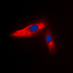 Anti-alpha Actinin 3 antibody used in Immunocytochemistry/ Immunofluorescence (ICC/IF). GTX54908
