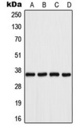 Anti-AKR1B1 antibody used in Western Blot (WB). GTX54911