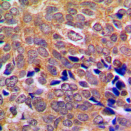 Anti-ABL antibody used in IHC (Paraffin sections) (IHC-P). GTX54914