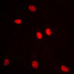Anti-ADAR2 antibody used in Immunocytochemistry/ Immunofluorescence (ICC/IF). GTX54916