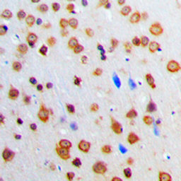 Anti-ADAR2 antibody used in IHC (Paraffin sections) (IHC-P). GTX54916