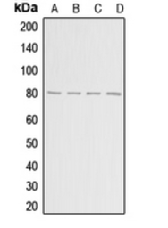 Anti-ADAR2 antibody used in Western Blot (WB). GTX54916