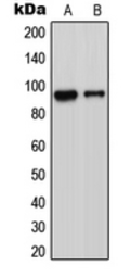 Anti-ADAM23 antibody used in Western Blot (WB). GTX54917