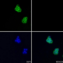 Anti-Aggrecan antibody used in Immunocytochemistry/ Immunofluorescence (ICC/IF). GTX54920