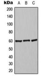 Anti-alpha 2c Adrenergic Receptor antibody used in Western Blot (WB). GTX54924