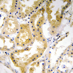 Anti-ABHD4 antibody used in IHC (Paraffin sections) (IHC-P). GTX54932
