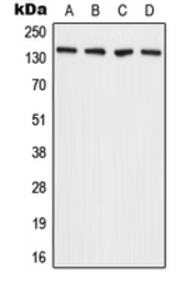 Anti-ADAMTS2 antibody used in Western Blot (WB). GTX54941