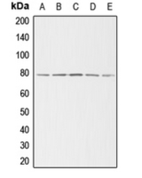 Anti-gamma Adducin antibody used in Western Blot (WB). GTX54942