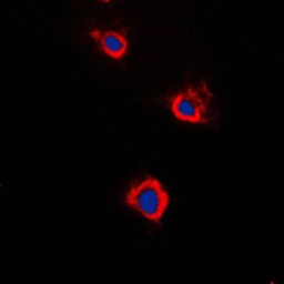 Anti-Adenylate cyclase 5/6 antibody used in Immunocytochemistry/ Immunofluorescence (ICC/IF). GTX54945