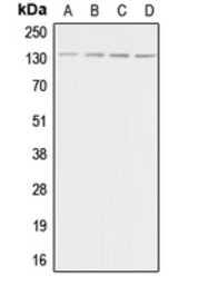Anti-Adenylate cyclase 5/6 antibody used in Western Blot (WB). GTX54945