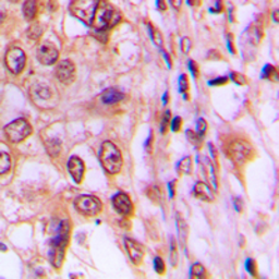 Anti-Cyclin D1 (phospho Thr286) antibody used in IHC (Paraffin sections) (IHC-P). GTX54957