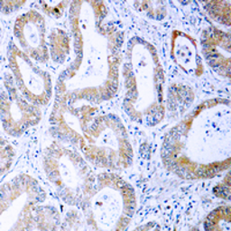 Anti-MEK1/2 (phospho Ser222/Ser226) antibody used in IHC (Paraffin sections) (IHC-P). GTX54969