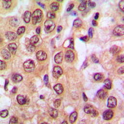 Anti-PTEN (phospho Ser370) antibody used in IHC (Paraffin sections) (IHC-P). GTX54979