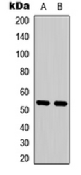 Anti-PTEN (phospho Ser370) antibody used in Western Blot (WB). GTX54979