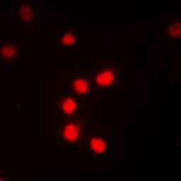 Anti-NFkB p65 (phospho Thr435) antibody used in Immunocytochemistry/ Immunofluorescence (ICC/IF). GTX54983