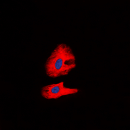 Anti-Ret (phospho Tyr1062) antibody used in Immunocytochemistry/ Immunofluorescence (ICC/IF). GTX54984