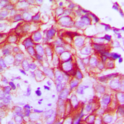 Anti-Ret (phospho Tyr1062) antibody used in IHC (Paraffin sections) (IHC-P). GTX54984