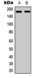 Anti-Ret (phospho Tyr1062) antibody used in Western Blot (WB). GTX54984