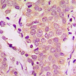 Anti-SHC1 (phospho Tyr239) antibody used in IHC (Paraffin sections) (IHC-P). GTX54986