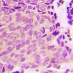 Anti-TSC2 (phospho Ser939) antibody used in IHC (Paraffin sections) (IHC-P). GTX54996
