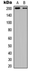 Anti-TSC2 (phospho Ser939) antibody used in Western Blot (WB). GTX54996