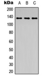 Anti-c-Abl (phospho Tyr204) antibody used in Western Blot (WB). GTX54998
