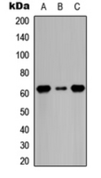 Anti-CDC6 (phospho Ser54) antibody used in Western Blot (WB). GTX55007