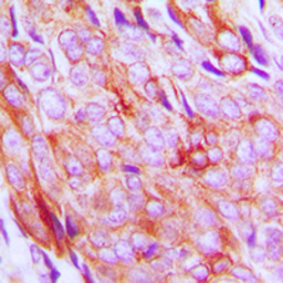 Anti-IGF1R beta (phospho Tyr1131) / Insulin Receptor beta (phospho Tyr1146) antibody used in IHC (Paraffin sections) (IHC-P). GTX55013