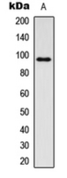 Anti-IGF1R beta (phospho Tyr1131) / Insulin Receptor beta (phospho Tyr1146) antibody used in Western Blot (WB). GTX55013